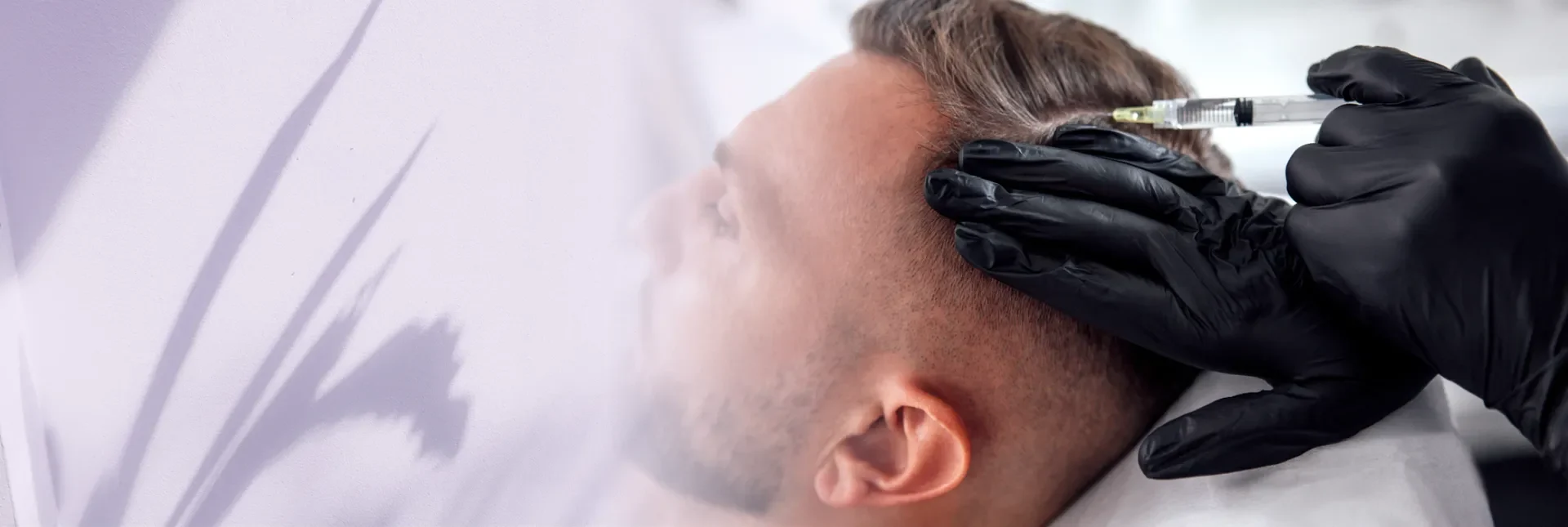 PRP & PRF Treatments – Regenerative Scalp Therapy