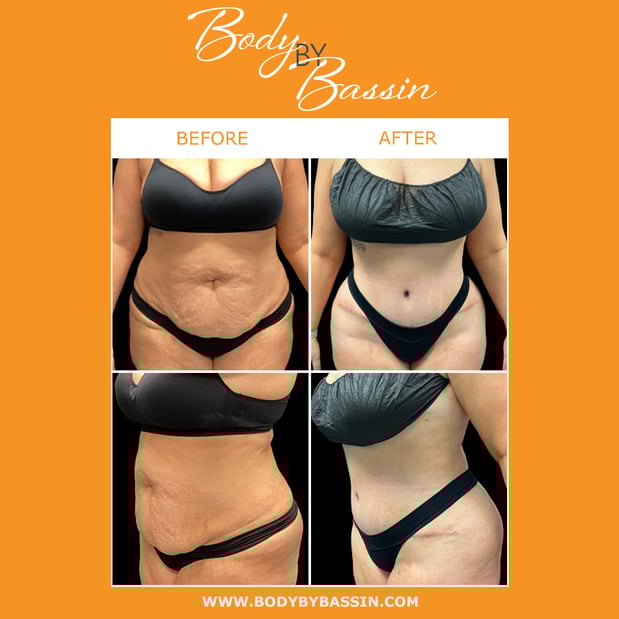 Images Body By Bassin Melbourne