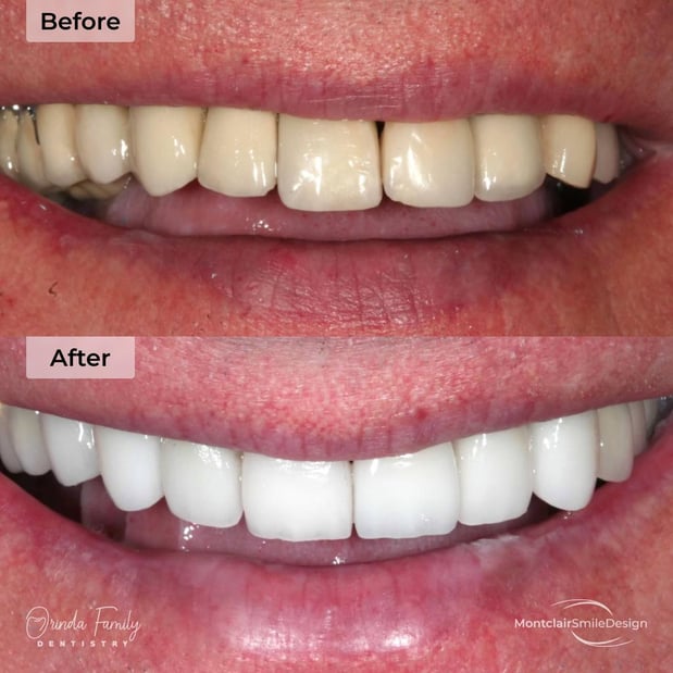 Images Orinda Family Dentistry