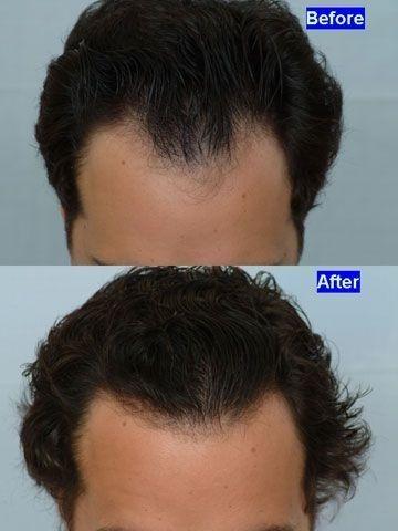 Images ForHair NYC Restoration Clinic - Dr. John Cole
