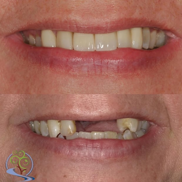 Images Reimels Family & Cosmetic Dentistry
