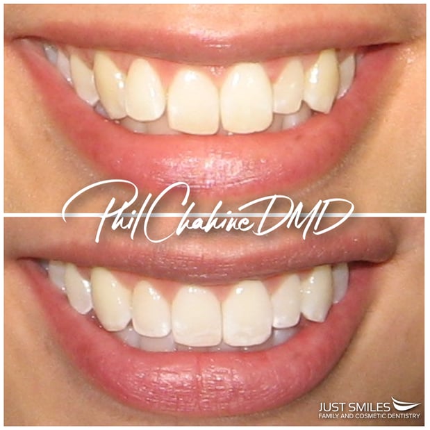 Images Just Smiles - General, Cosmetic & Implant Dentistry