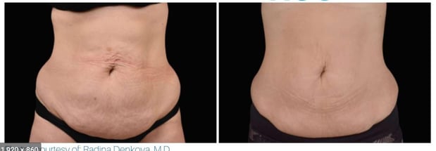 Images Renew Body Contouring & MedSpa