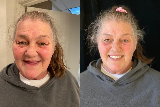 Images Bosler Implant & Cosmetic Dentistry