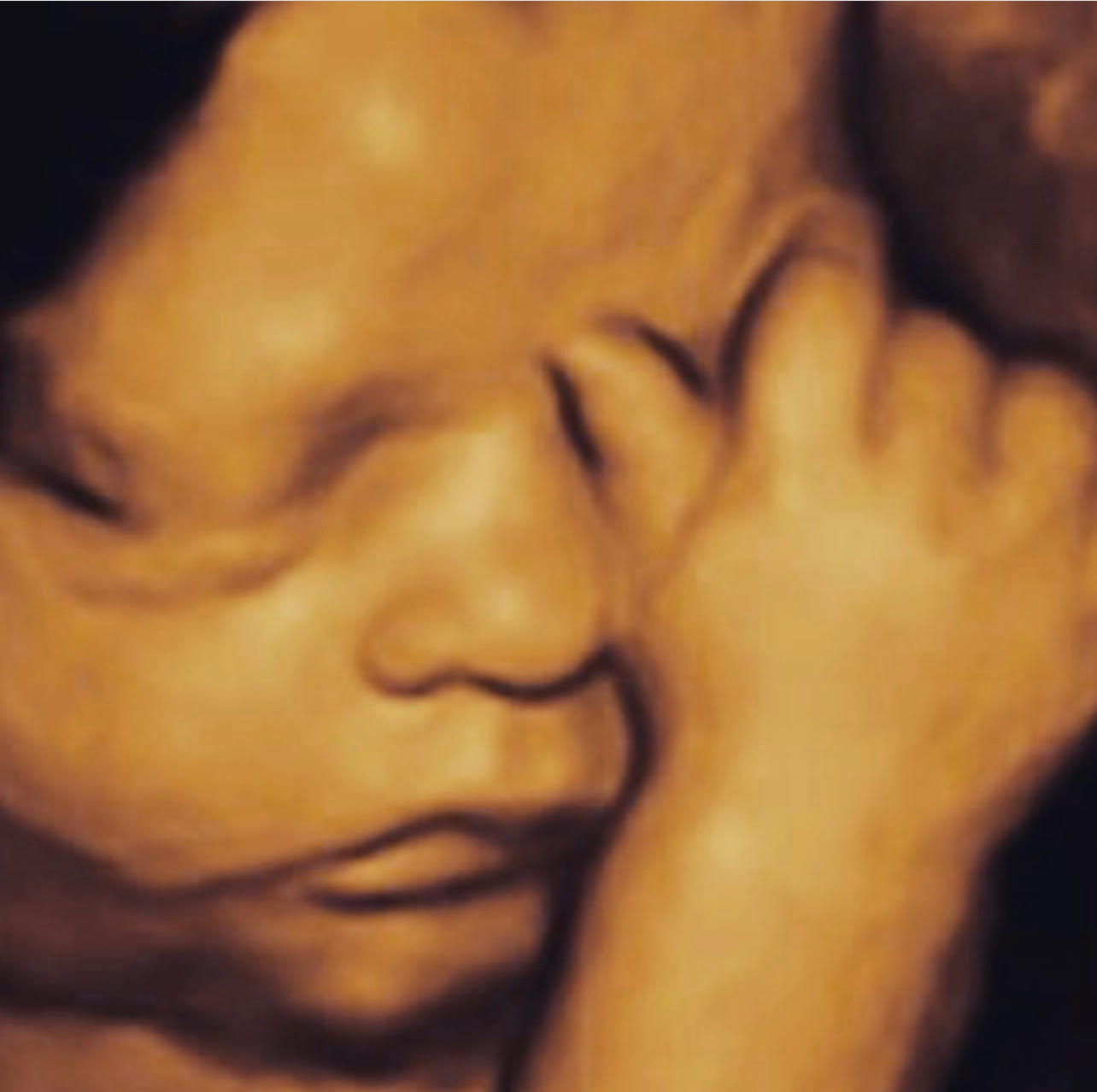 Image 2 | Belly 2 Birth 3D 4D Ultrasound