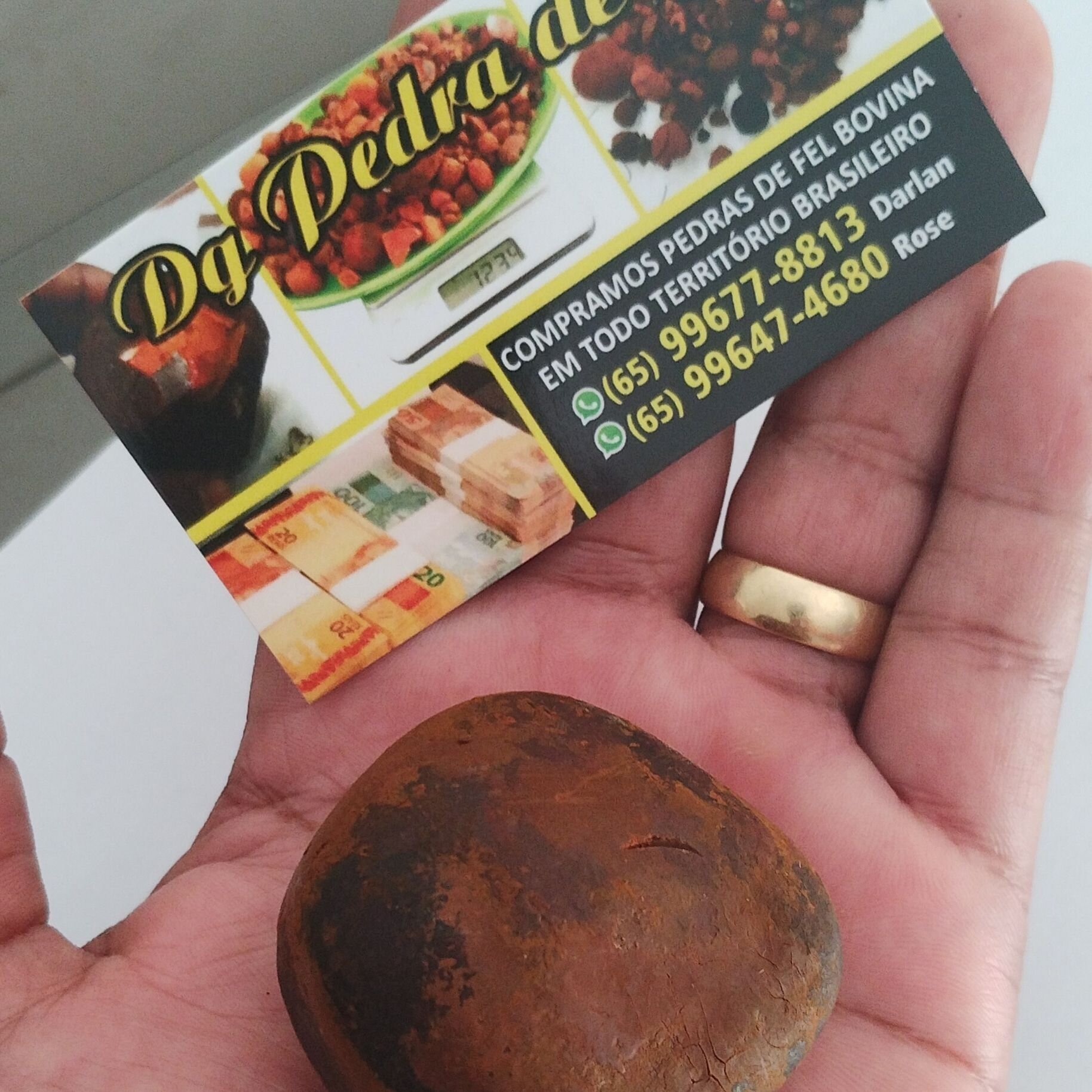 Images Dg pedras de fel bovinos