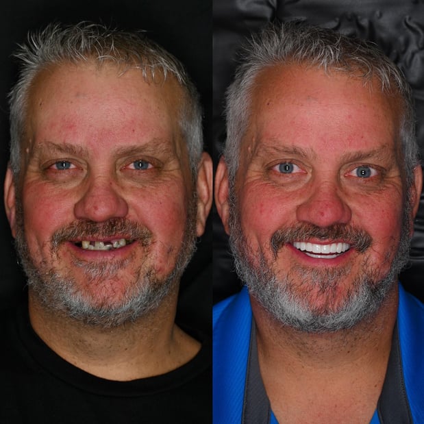 Images Nashville Wisdom Teeth and Implant Solutions