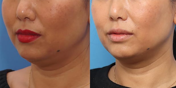 Images EliteBio: Hormone and Aesthetic Solutions