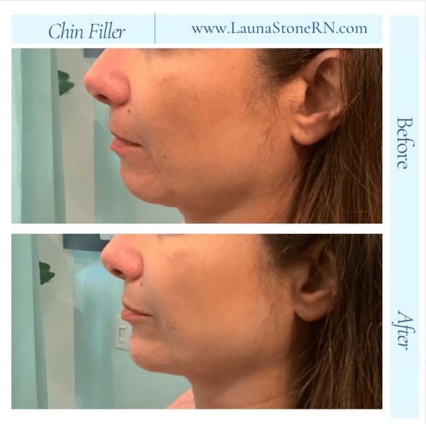 Images Launa Stone, R.N.