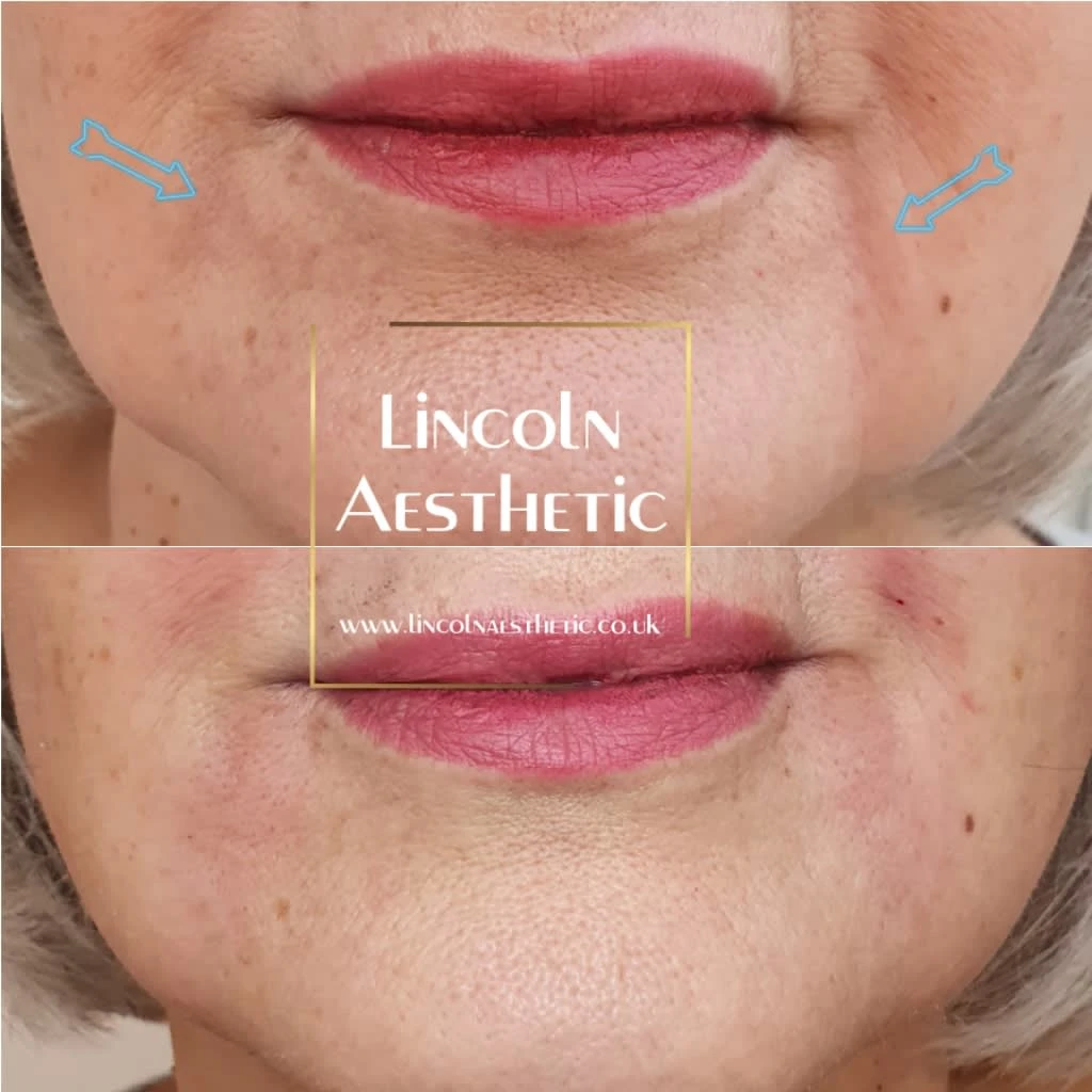 Images Lincoln Aesthetic