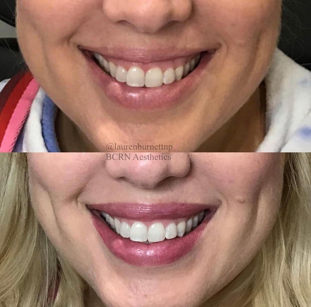 Images BCRN Aesthetics MedSpa