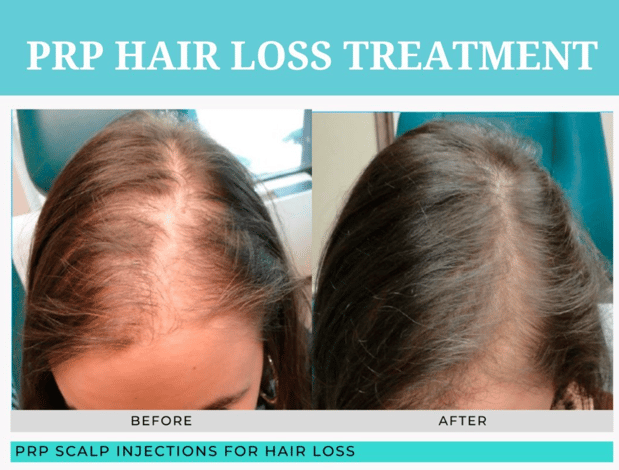 Images Supriya Aesthetic Dermatology