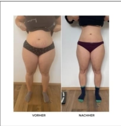 Bilder Abnehmen im liegen St Gallen