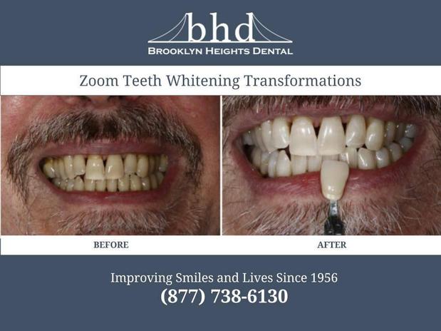 Images Brooklyn Heights Dental