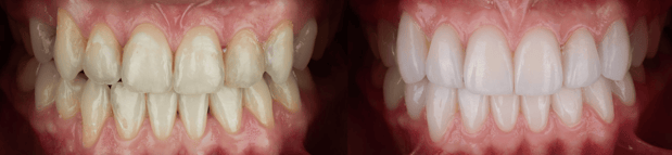 Images Jeppson Dental