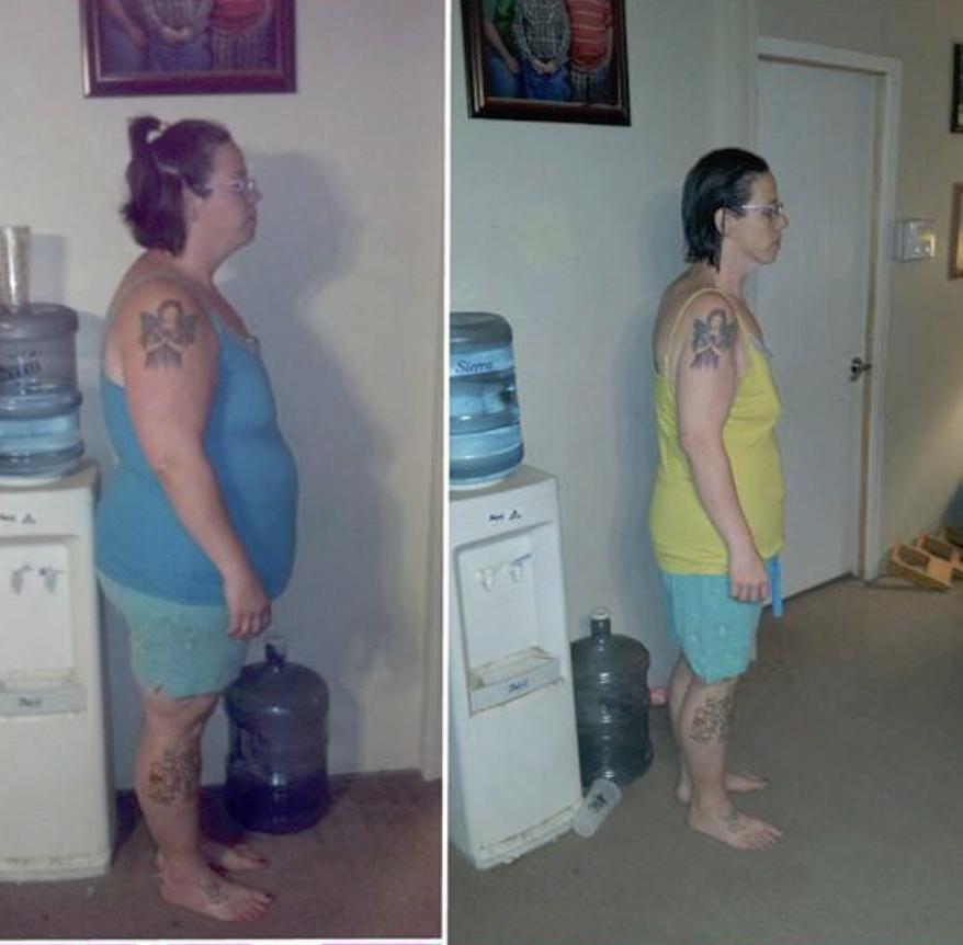 Patient Photo Panhandle Weight Loss Center Amarillo (806)677-7952