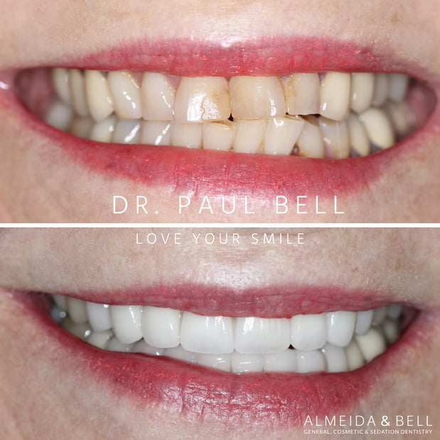 Images Almeida & Bell Dental Lone Tree - General, Cosmetic, and Implant Dentistry