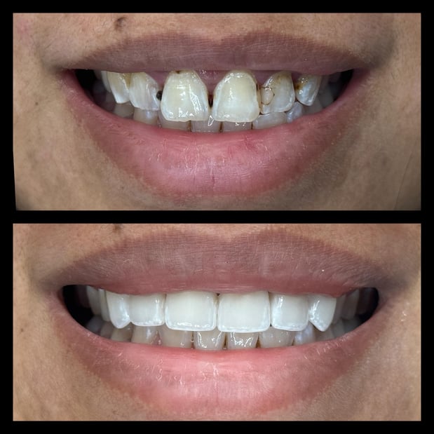 Images smile4me Dental Care - Astoria, Queens