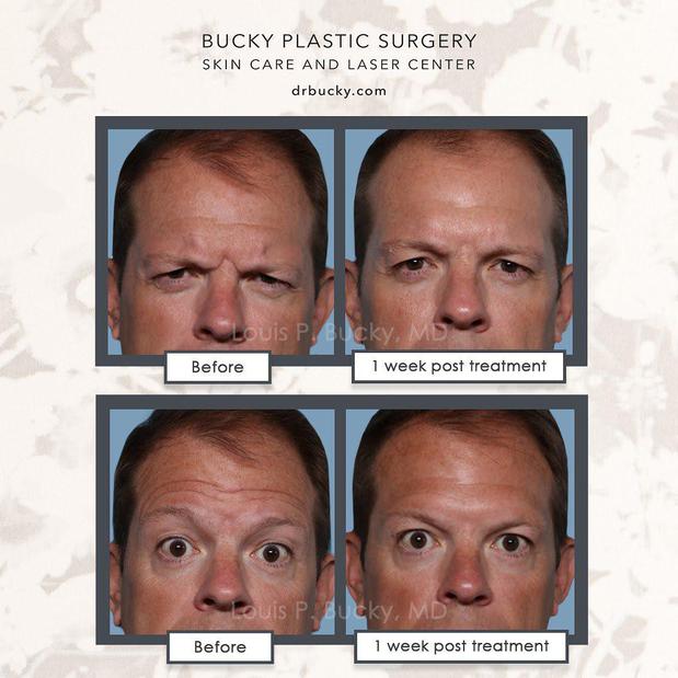 Louis P. Bucky, MD, FACS in Philadelphia, 230 West Washington Square - Cosmetic Surgery in ...