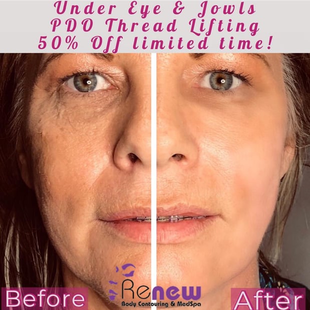 Images Renew Body Contouring & MedSpa