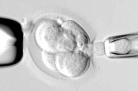 Center for Assisted Reproduction Photo