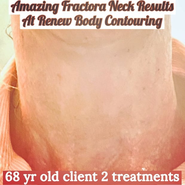 Images Renew Body Contouring & MedSpa