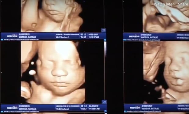 Images Heavenly 3D 4D Ultrasounds
