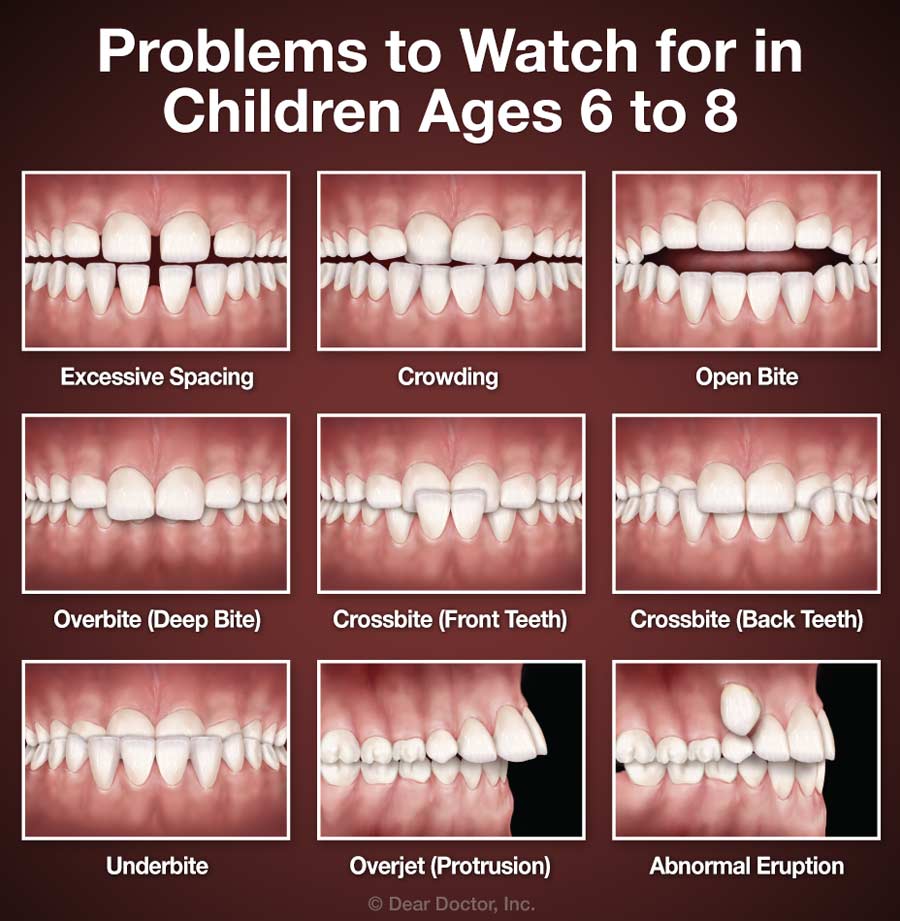Cox Orthodontics - Carnes/Cane Bay