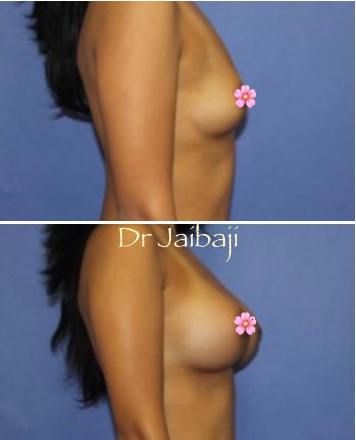 Jaibaji Plastic Surgery Photo