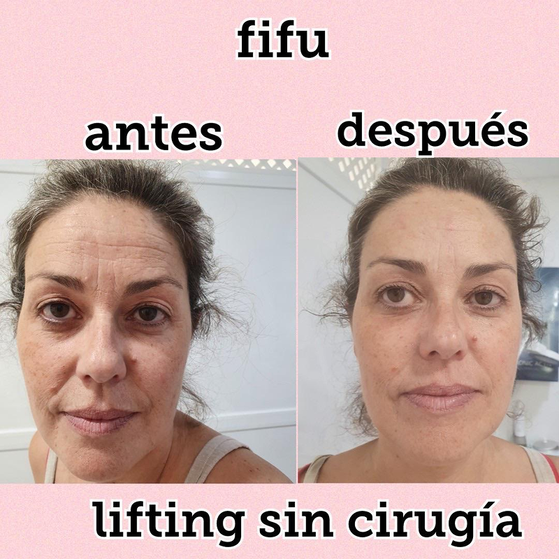 Images Centro De Estética Avanzada Y Láser Verónica Vico