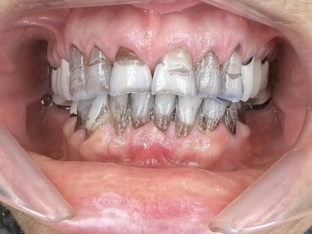 Images Nicole E. Kuske, DDS