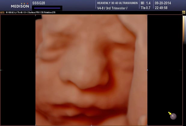 Images Heavenly 3D 4D Ultrasounds-Upland
