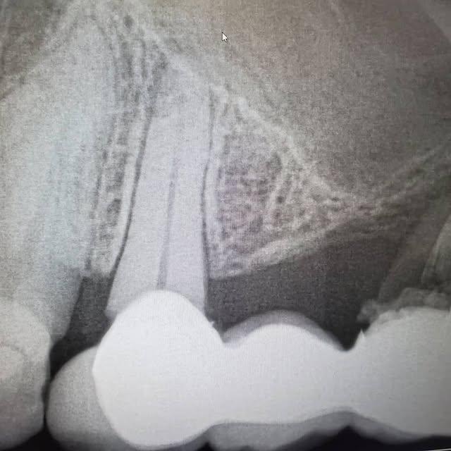 Images Smiles By Eddie: Dr. Edmond Ahdoot DDS