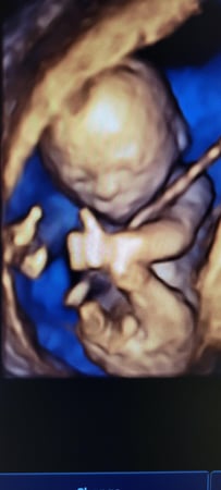 Images Love At First Sight 3D/4D Ultrasound Imaging Studio, LLC