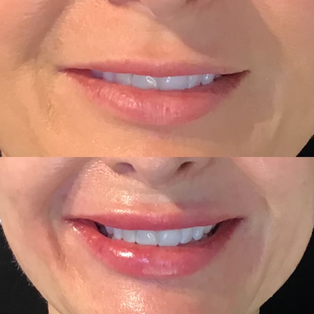 Images BCRN Aesthetics MedSpa