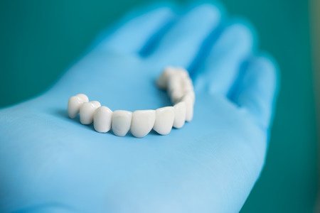 Bridges ACCU Dental