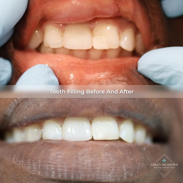 Images Green Meadows Dental Connection