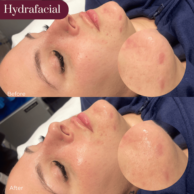Images Artistry Of Face - Loudonville
