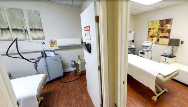 Images Alite Laser - Onion Creek