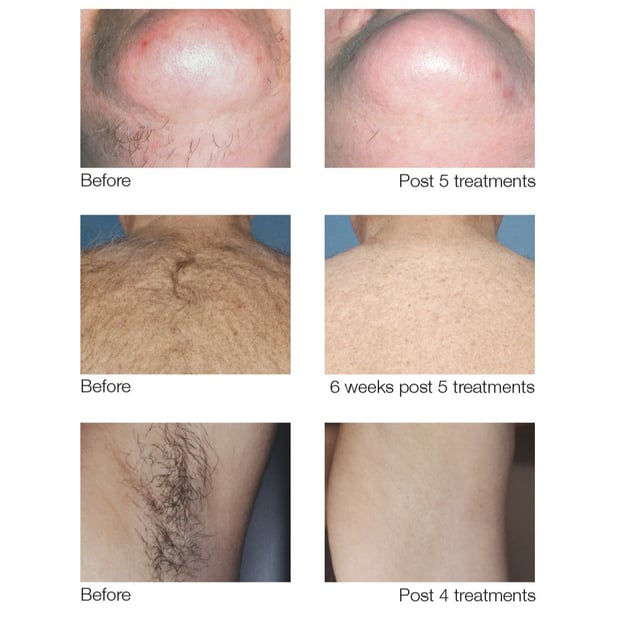 Images Permanent Makeup & Aesthetics in Maine