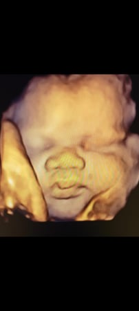 Images Love At First Sight 3D/4D Ultrasound Imaging Studio, LLC