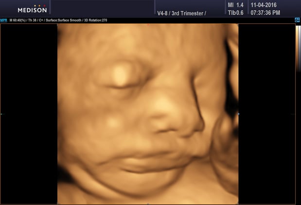 Images Heavenly 3D 4D Ultrasounds