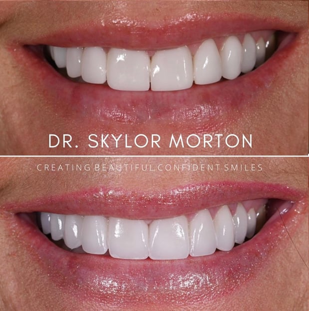 Images Nashville Wisdom Teeth and Implant Solutions
