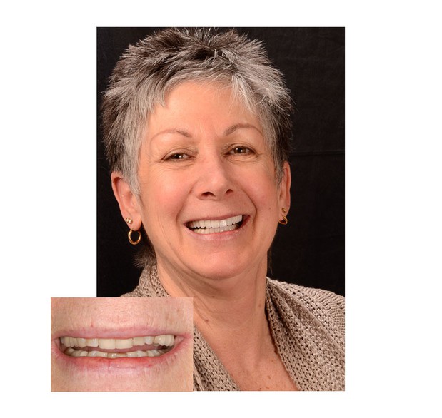 Images San Diego Smiles