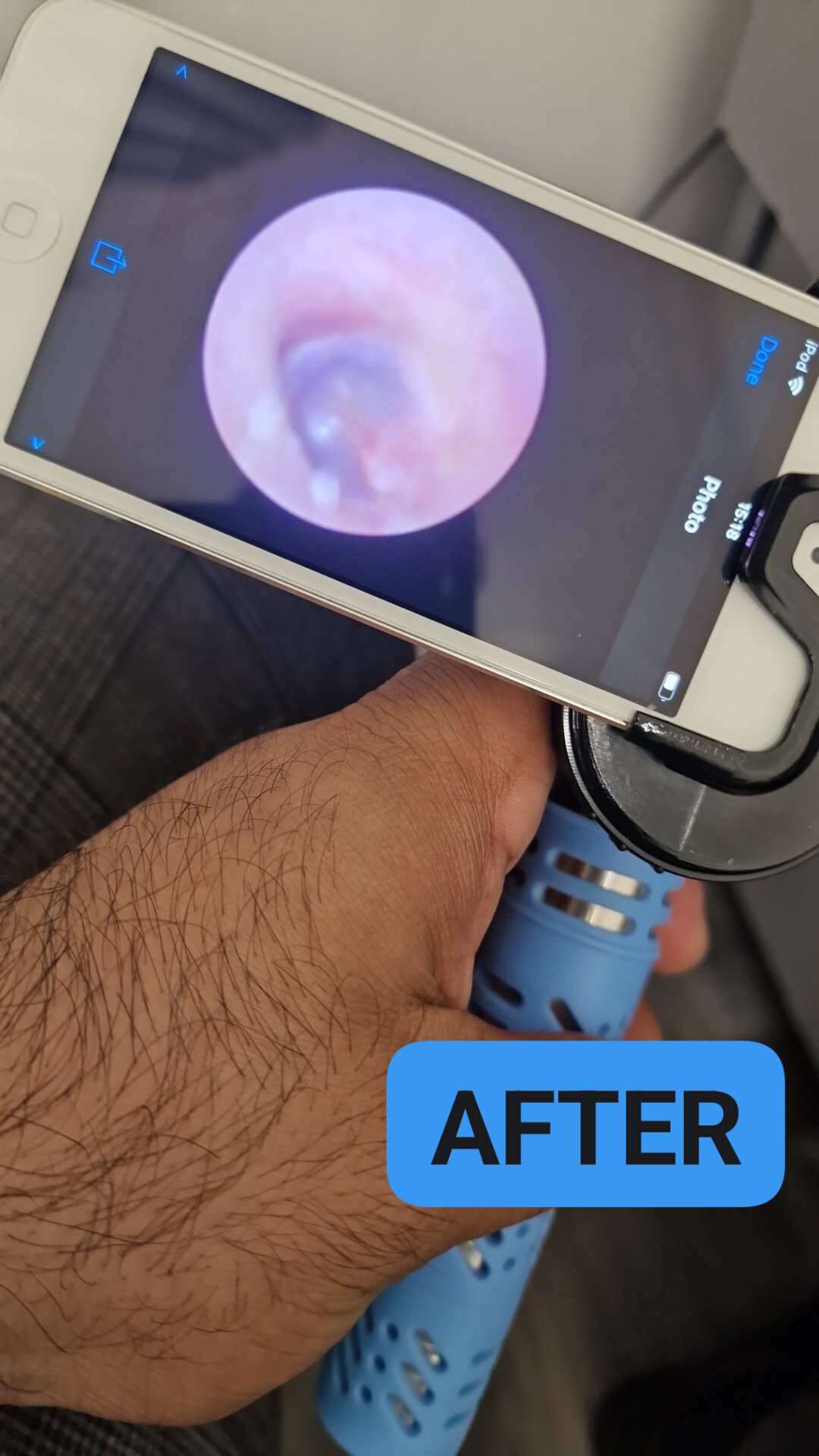 Images MW Ear Wax Removal