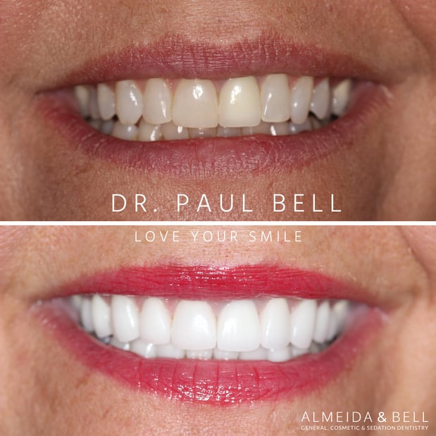 Images Almeida & Bell Dental Lone Tree - General, Cosmetic, and Implant Dentistry