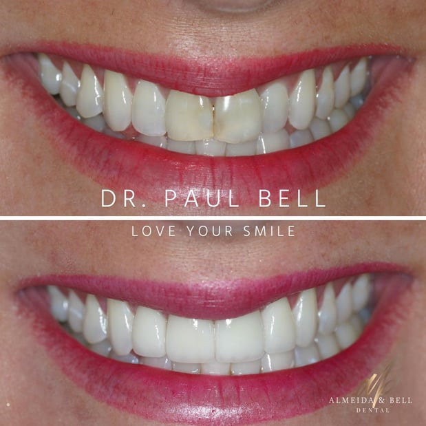 Images Almeida & Bell Dental Lone Tree - General, Cosmetic, and Implant Dentistry