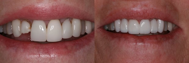 Images Campbell Dental Arts