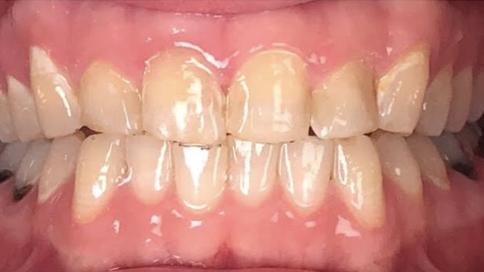 Images Enrich Dental