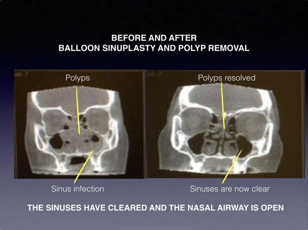Images Sinus & Snoring Specialists